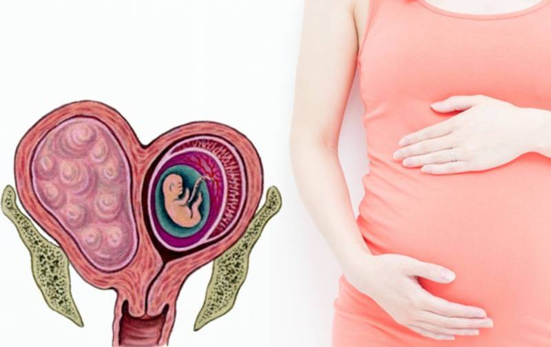 Детская матка: можно ли забеременеть и родить женщине с такой патологией?
