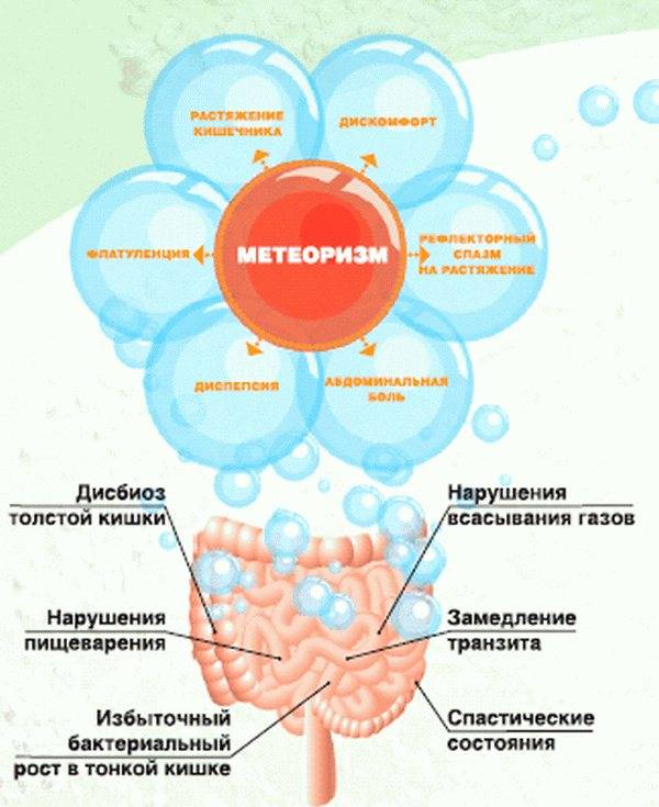 Метеоризм: причины, диагностика и лечение в москве