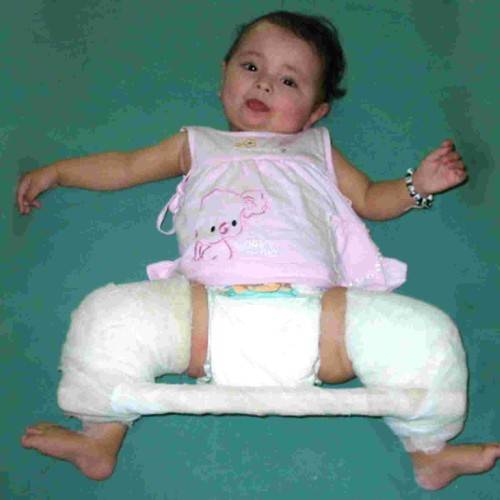 Узи тазобедренных суставов новорожденным