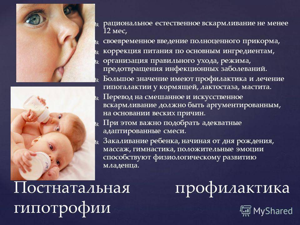 Гипотрофия у ребенка - симптомы болезни, профилактика и лечение гипотрофии у ребенка, причины заболевания и его диагностика на eurolab