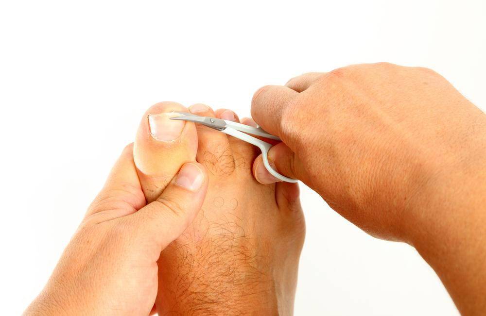 Как подстричь ногти новорожденному (проблема вросшего ногтя у грудничка)