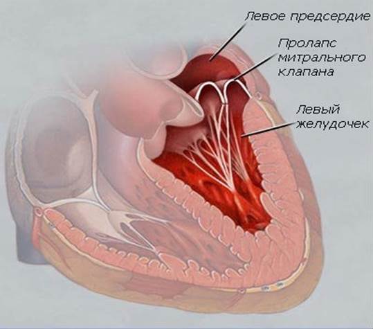 Эхокг (эхокардиография, узи сердца) — метод, позволяющий увидеть сердце