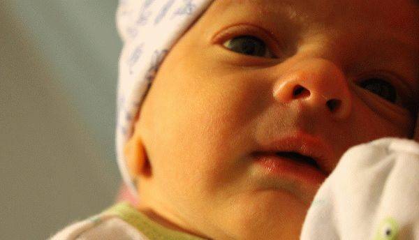Когда у малыша пройдет младенческая желтуха? | детская городская поликлиника № 32