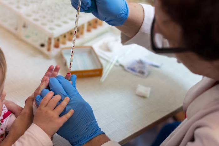 Дети сдают кровь из пальца натощак или нет - можно ли кушать перед общим клиническим анализом? - мытищинская городская детская поликлиника №4