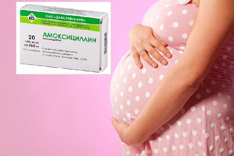 Антибиотики при беременности: почему нельзя и когда можно