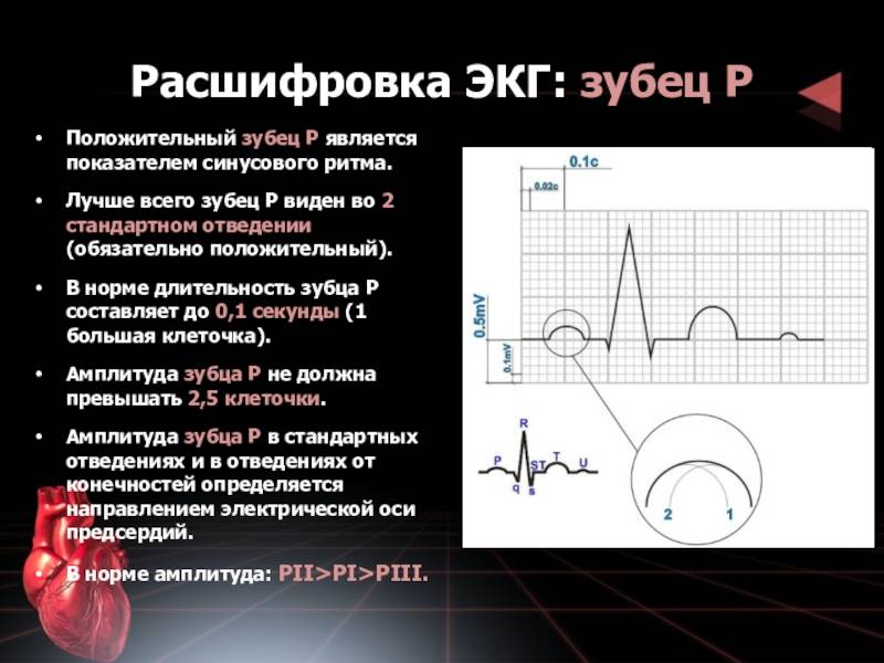 Основные элементы экг: что содержит график кардиограммы