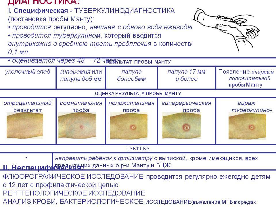 Какой результат реакция. Реакция манту норма у детей 5 лет. Размеры реакции манту у детей норма. Реакция манту норма у детей 8 лет. Прививка манту норма у ребенка 1.5 года.