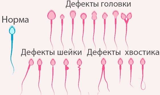 Фертильность сперматозоидов мужчины
