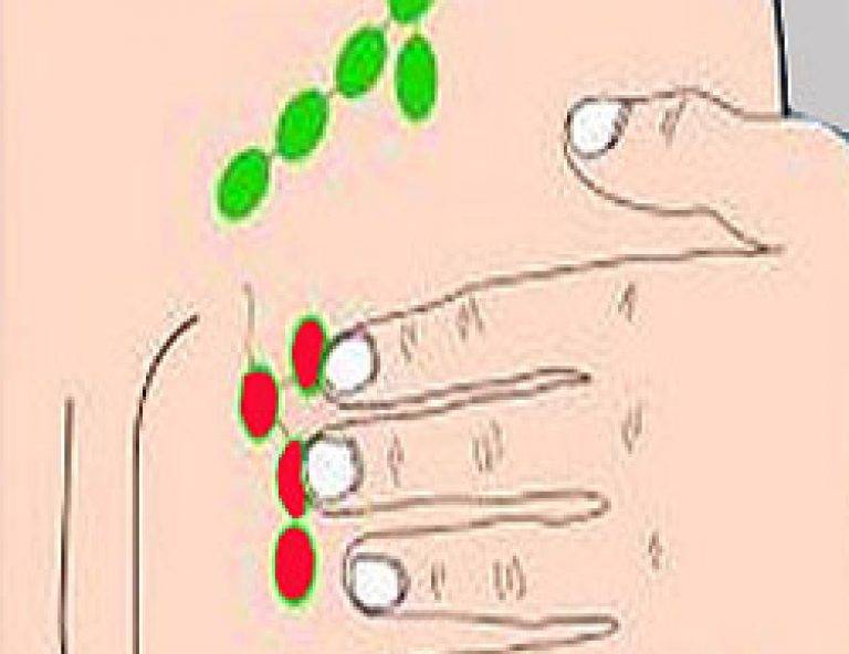 Боль в области паха | компетентно о здоровье на ilive