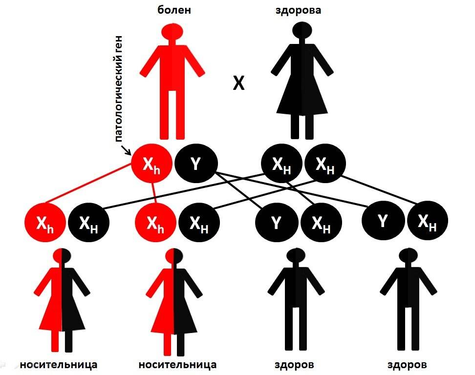 Муж переходит по наследству. Схема наследования гемофилии. Схема передачи гемофилии по наследству. Гемофилия передается по наследству. Гемофилия Тип наследования.
