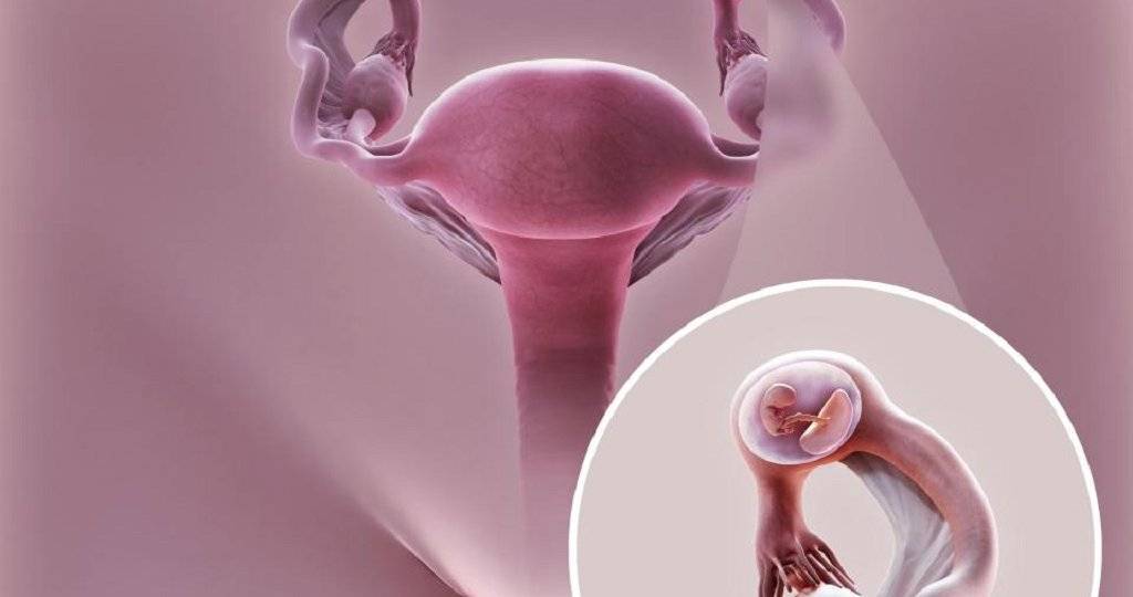 «достинексовые / каберголиновые  детки». всё о лечении гиперпролактинемии при беременности