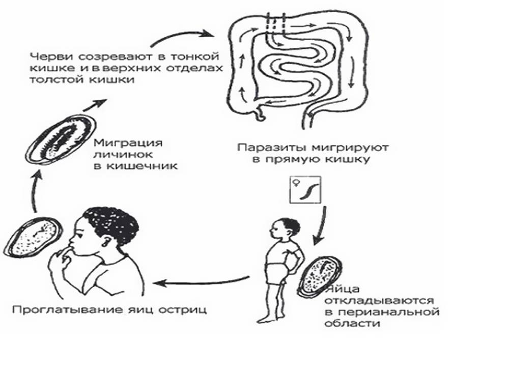 Симптомы энтеробиоза у детей, схема лечения и профилактика заболевания