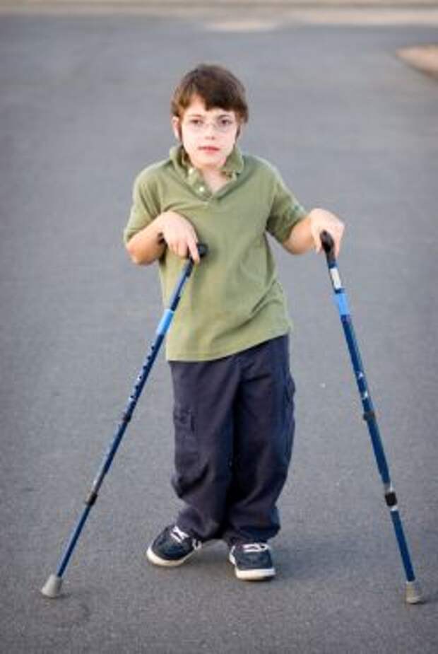 Детский церебральный паралич - дцп | ким