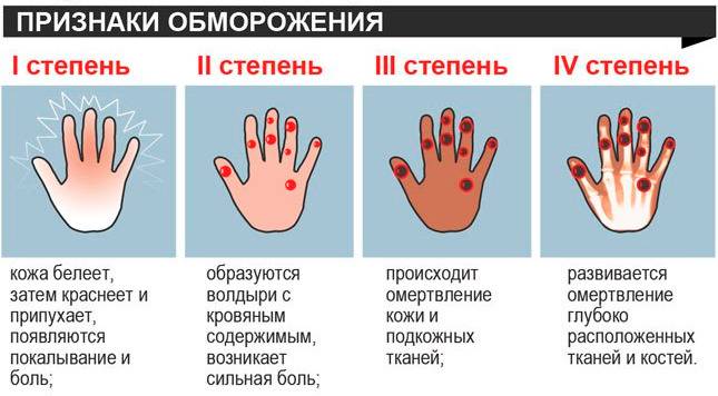 Онемение пальцев рук и ног.  к какому врачу обращаться при онемении конечностей
