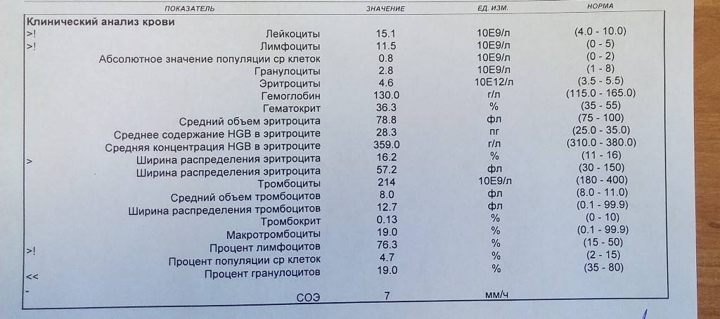 Иммуноглобулин Е: норма у детей, повышенные и низкие показатели в общем анализе крови (таблица)