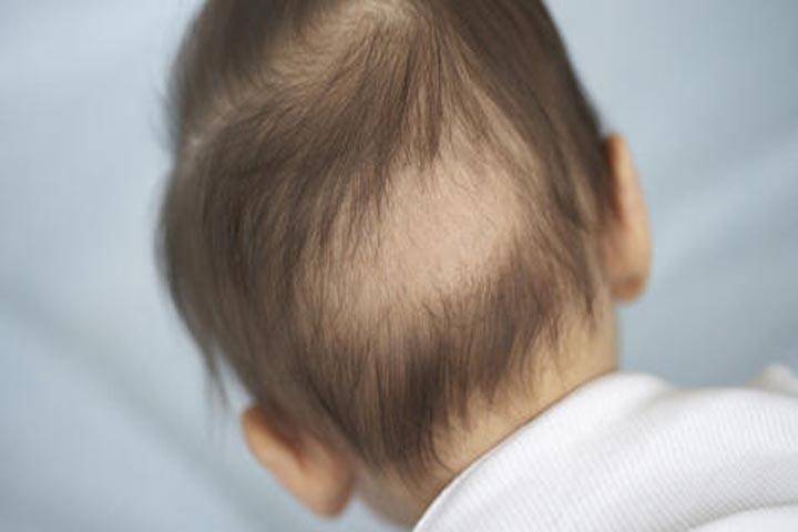 Выпадают волосы у грудничка (14 фото): причины залысин на затылке и облысения у новорожденного ребенка
