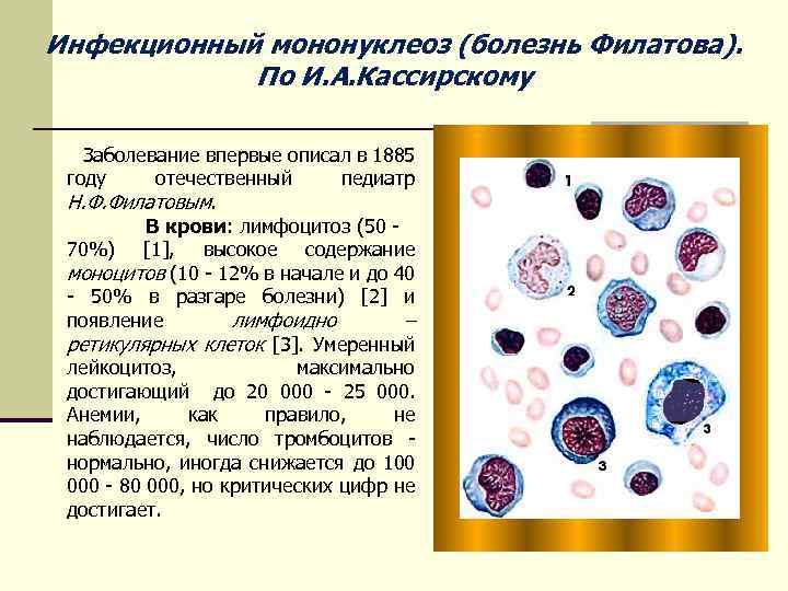 Инфекционный мононуклеоз