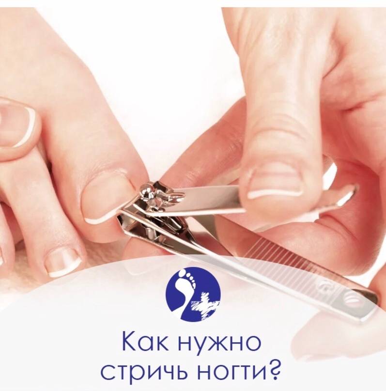 «типичная ошибка — неправильно стричь ногти». подолог о проблемах стоп, которые нужно лечить у врача