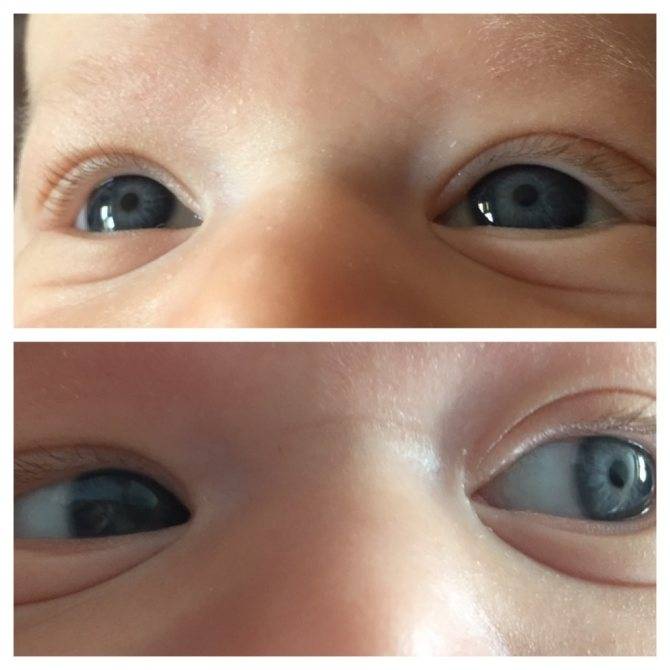 Меняется ли цвет глаз у новорожденных?