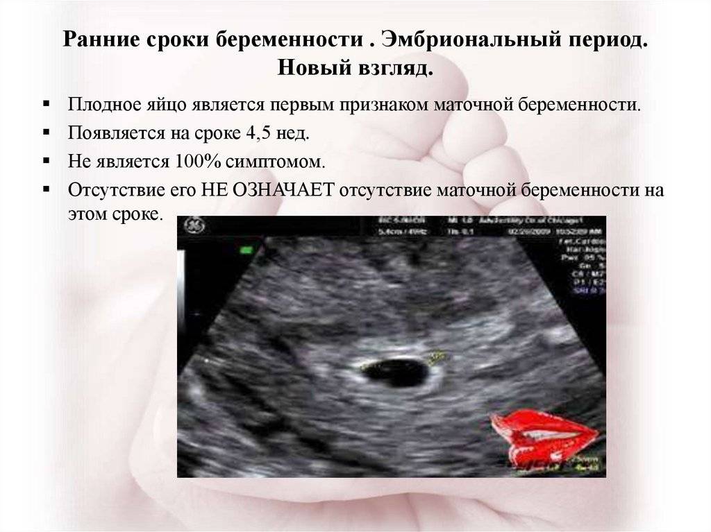 Первые недели зачатия симптомы. Беременность на ранних сроках. Срок беременности на ранних сроках. Начальные сроки беременности. Беременность ранний срок симптомы беременности.