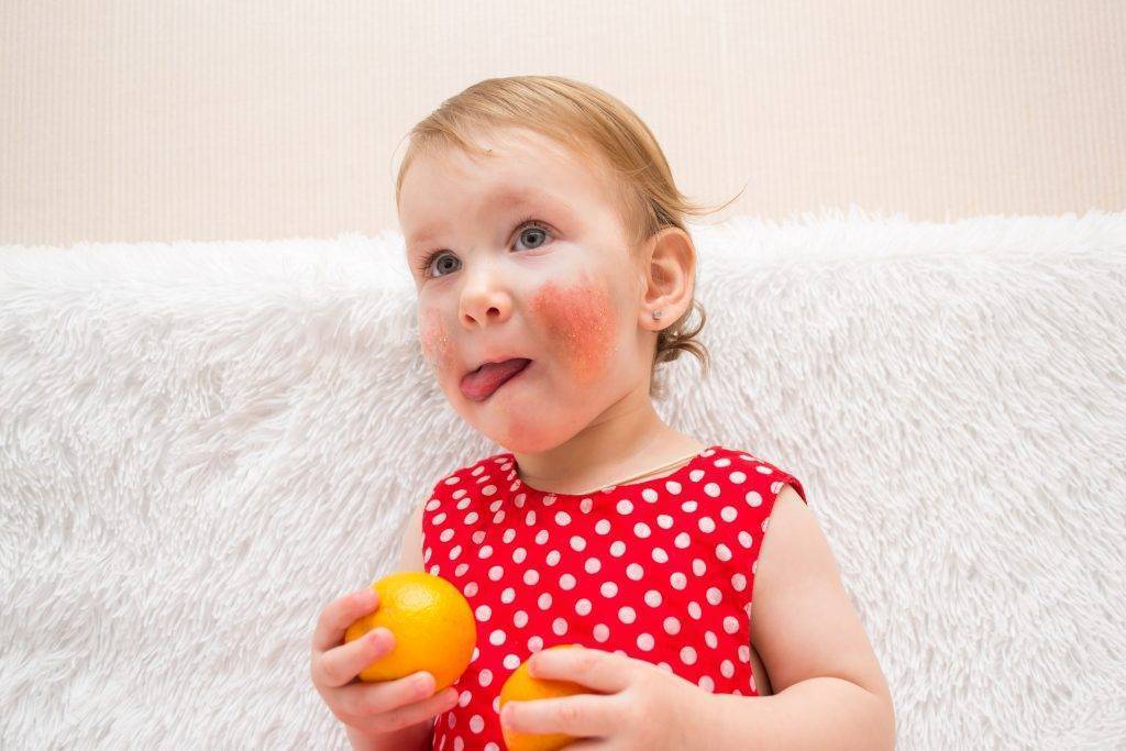 С какого возраста можно давать ребенку мед, бывает ли на него аллергия?