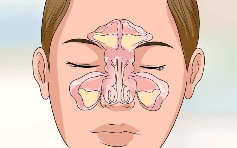 Эндоскопия носа и носоглотки - лучший способ диагностики заболеваний носовой полости