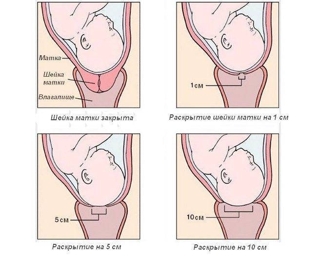 Угроза преждевременных родов и препараты прогестерона. дюфастон или утрожестан?