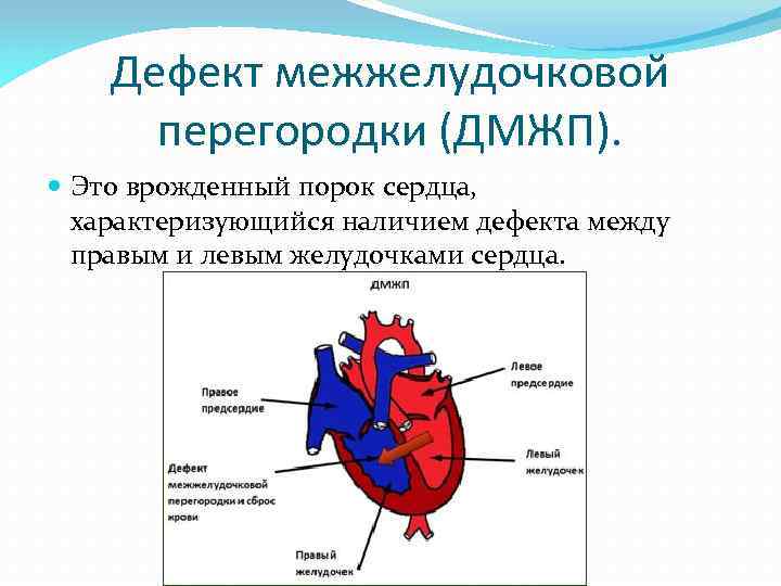 Патологии сердца плода, которые можно определить на скрининговом узи