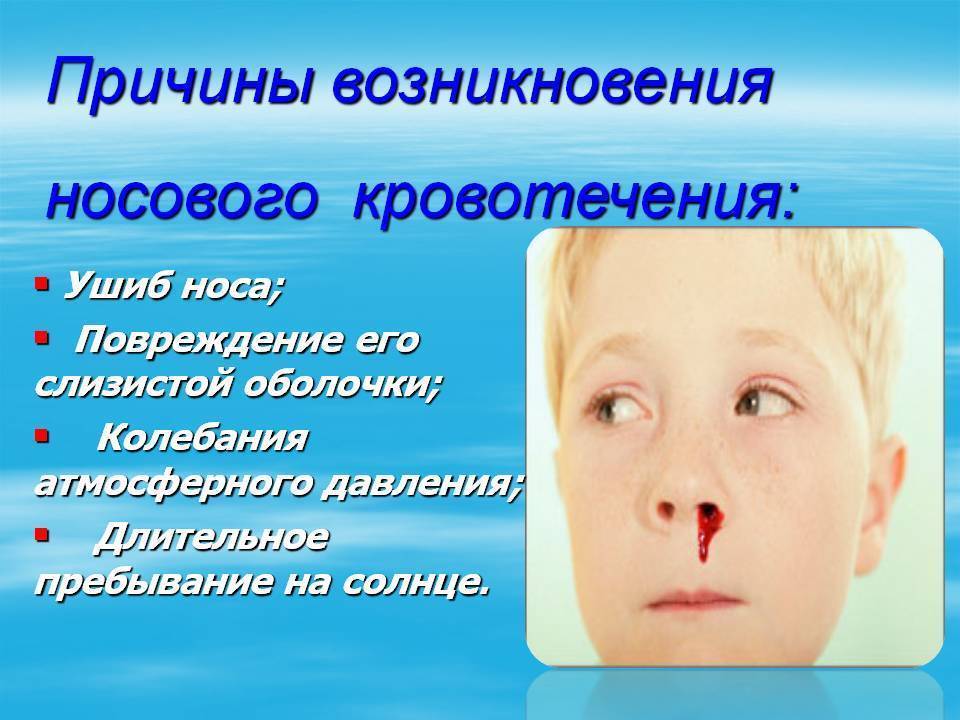 Кровь из носа у взрослого, у детей, при беременности, причины, симптомы, что делать? носовое кровотечение первая помощь.