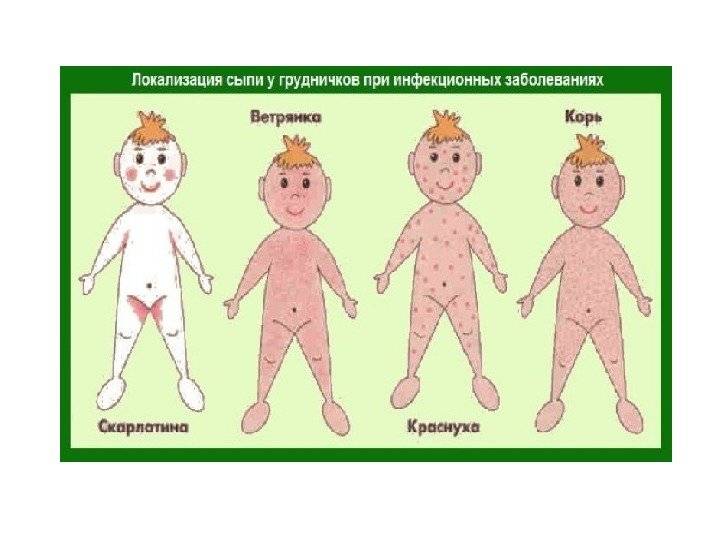 Сыпь у детей таблица виды при различных заболеваниях фото и название