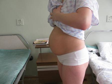 Каменеет живот на 37 неделе беременности: причины, диагностика, опасные симптомы - мытищинская городская детская поликлиника №4