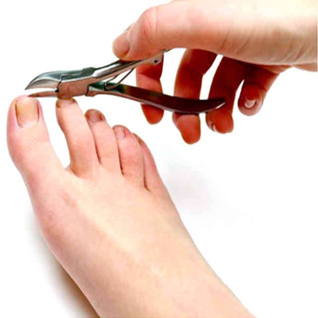 Псориаз ногтей: как привести ногти в порядок?