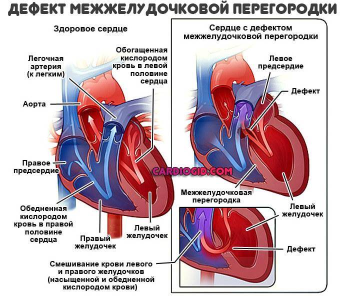 Патологии сердца плода, которые можно определить на скрининговом узи * клиника диана в санкт-петербурге