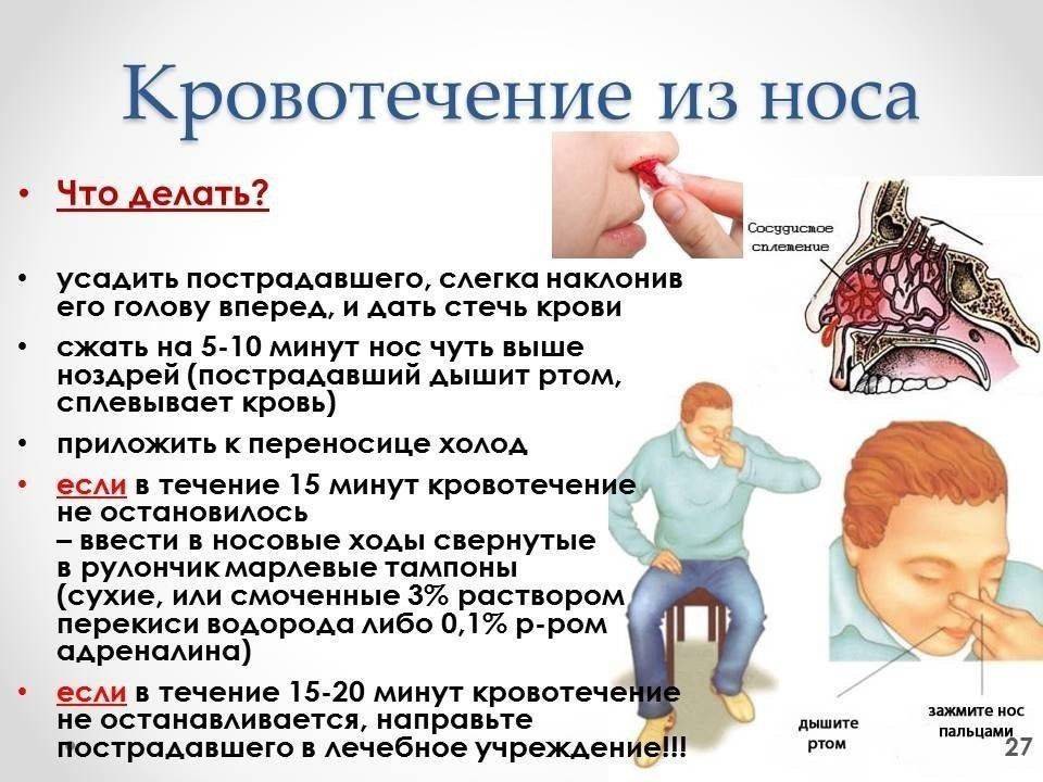 Кровотечение из носа: причины, первая помощь и народные средства - новости yellmed.ru