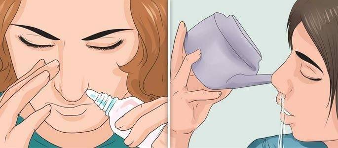 Как лечить заложенность носа при насморке?
