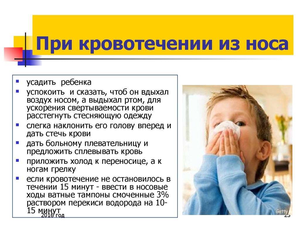 Чем опасны носовые кровотечения у детей и как их лечить