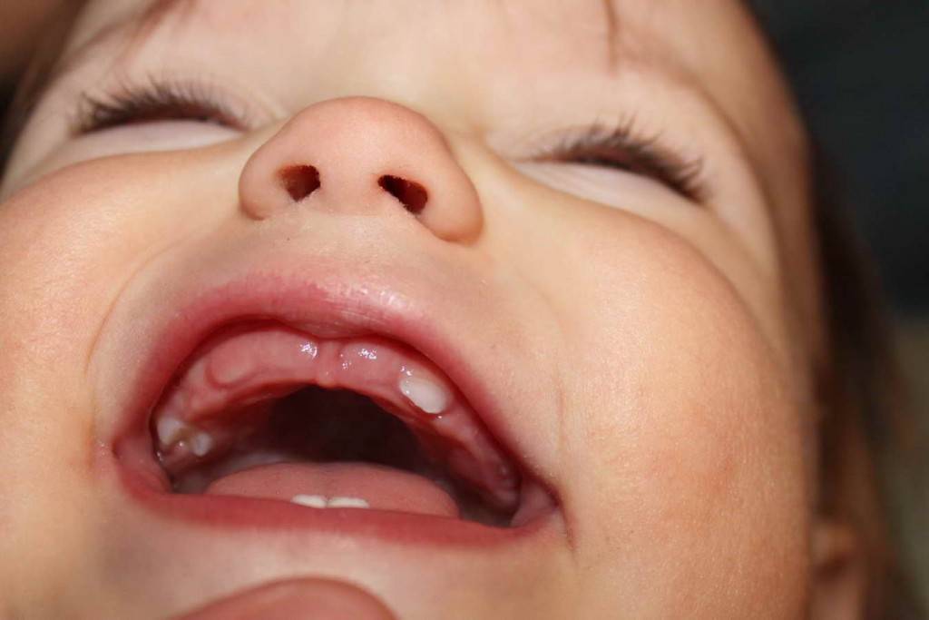 Когда выпадают молочные зубы у детей
