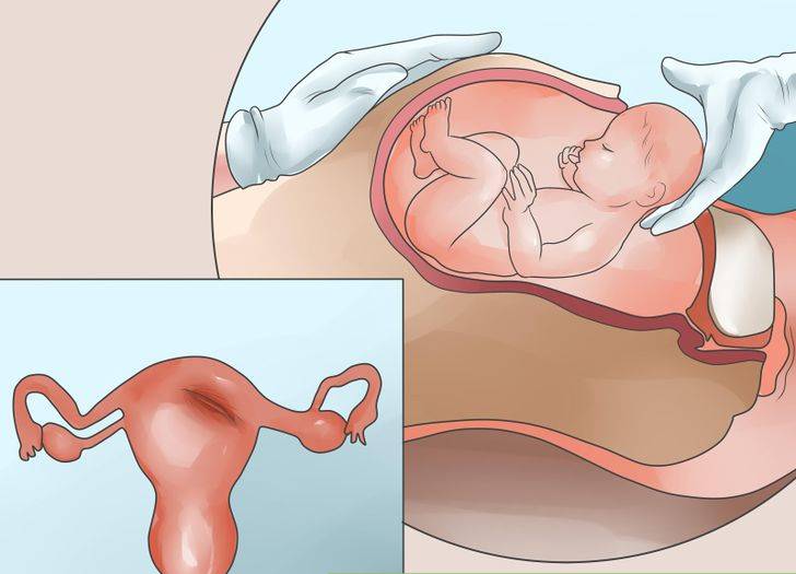 Почему выходит воздух из матки, влагалища, причины и симптомы