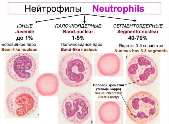 Агранулоцитоз и нейтропения — недостаточность нейтрофилов | университетская клиника