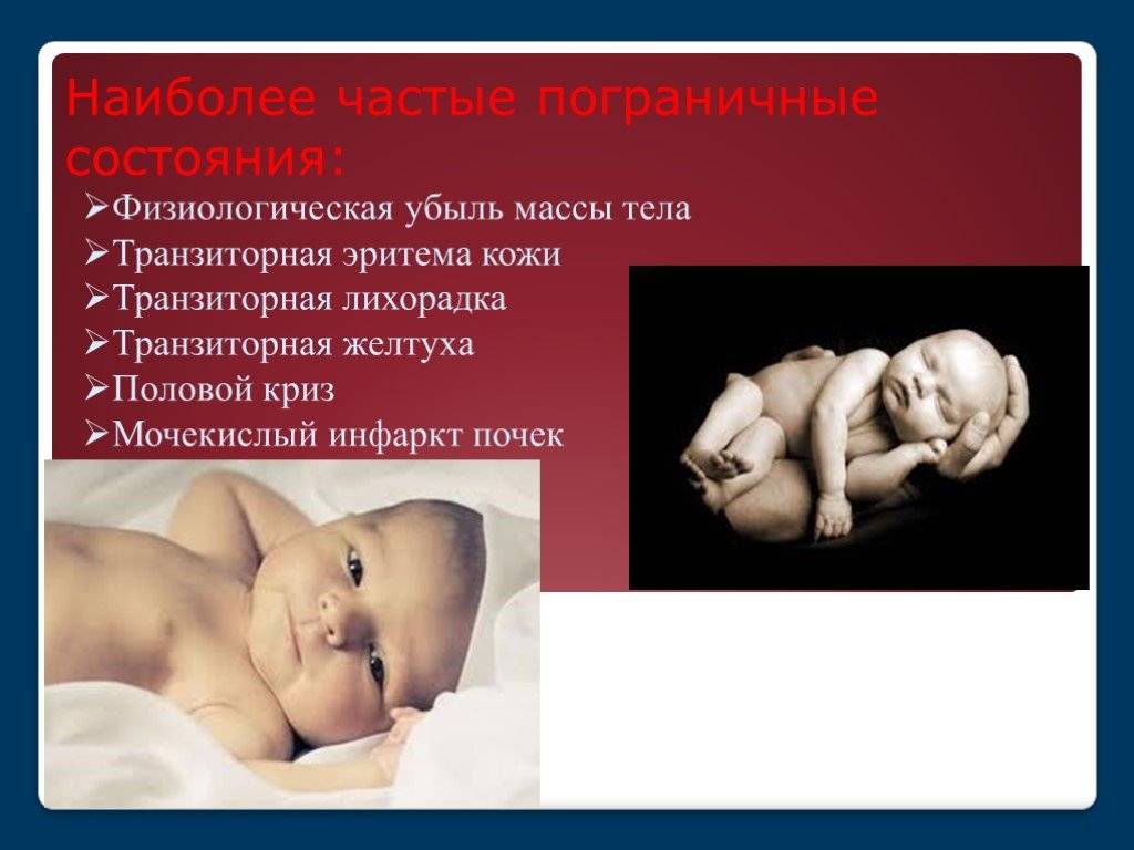 Все о переходных (пограничных) состояниях новорожденного ребенка