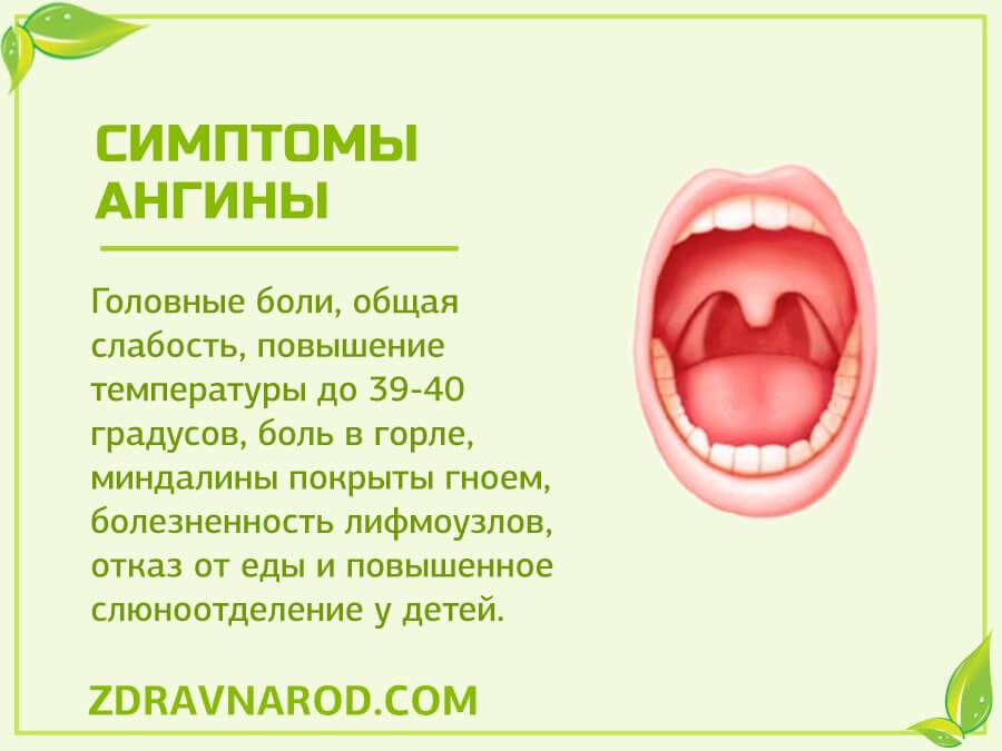 Хронический тонзиллит у детей