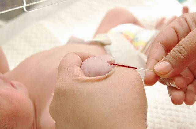 Как подготовить младенца к сдаче крови из вены?