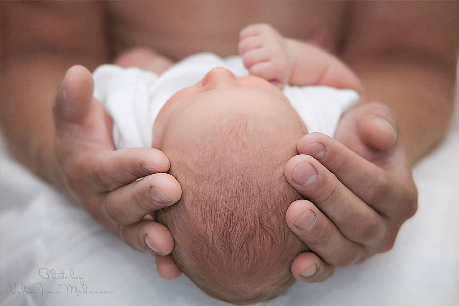 Маленький родничок у новорожденного: последствия раннего закрытия темечка
