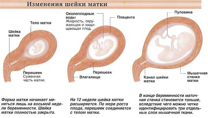 Шейка матки во время месячных фото