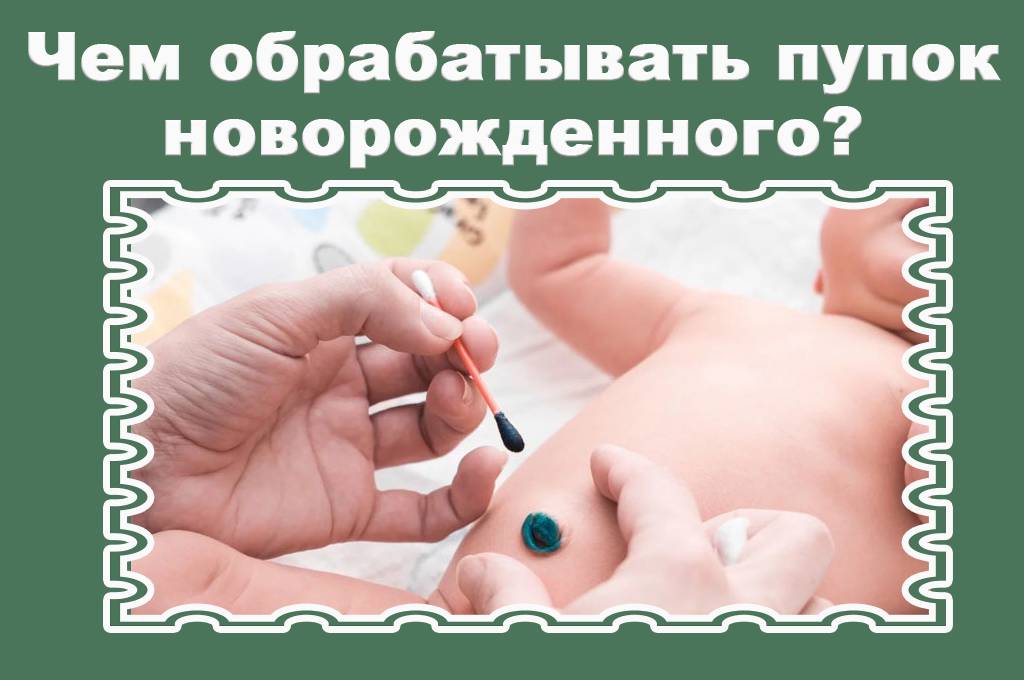 Обработка пупочной ранки у новорожденного ребенка в домашних условиях (пупка)
