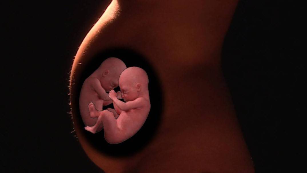 Икота плода в утробе матери: норма или патология?