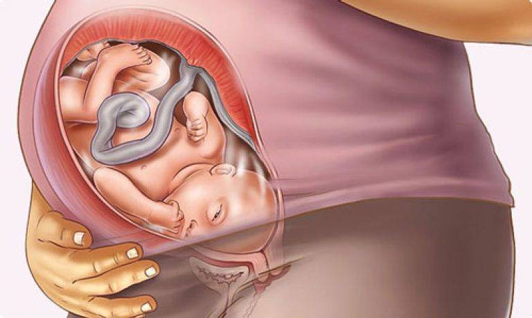 Переношенная беременность: чем опасны роды?