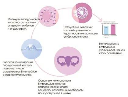 Подсадка (перенос) эмбрионов при эко