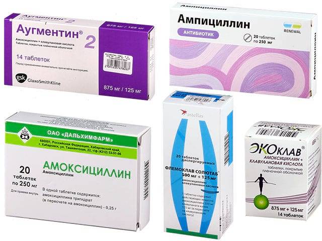 Антибиотики при тонзиллите : инструкция по применению | компетентно о здоровье на ilive