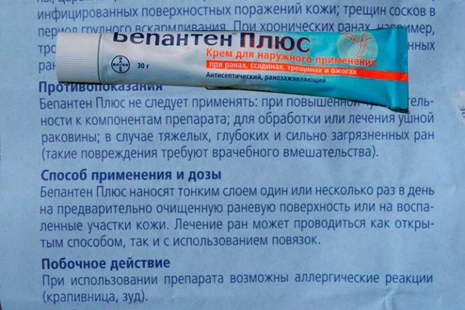 Опрелости у ребенка: как выглядят, диагностика и возможные осложн